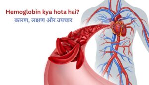 Read more about the article Hemoglobin Kya Hota Hai – हीमोग्लोबिन कमी के लक्षण और उपचार